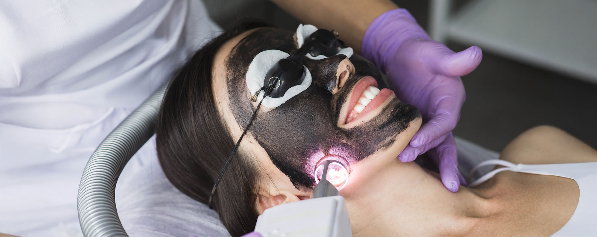 Hollywood Peeling - Peeling laser au carbone à Lausanne
