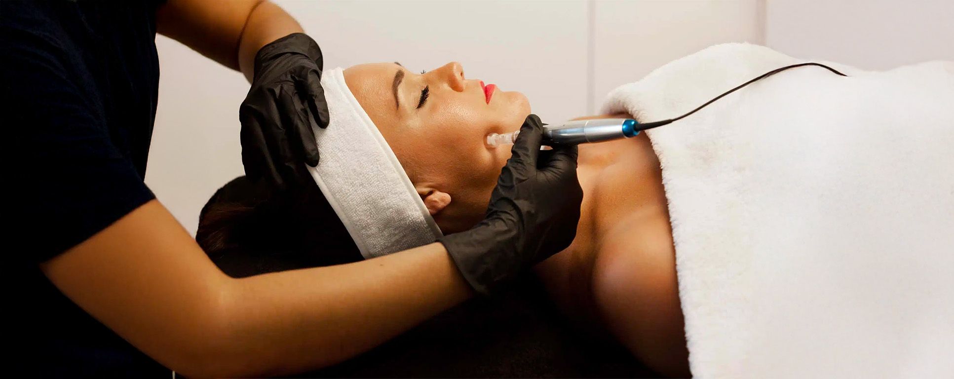 Microneedling à Lausanne