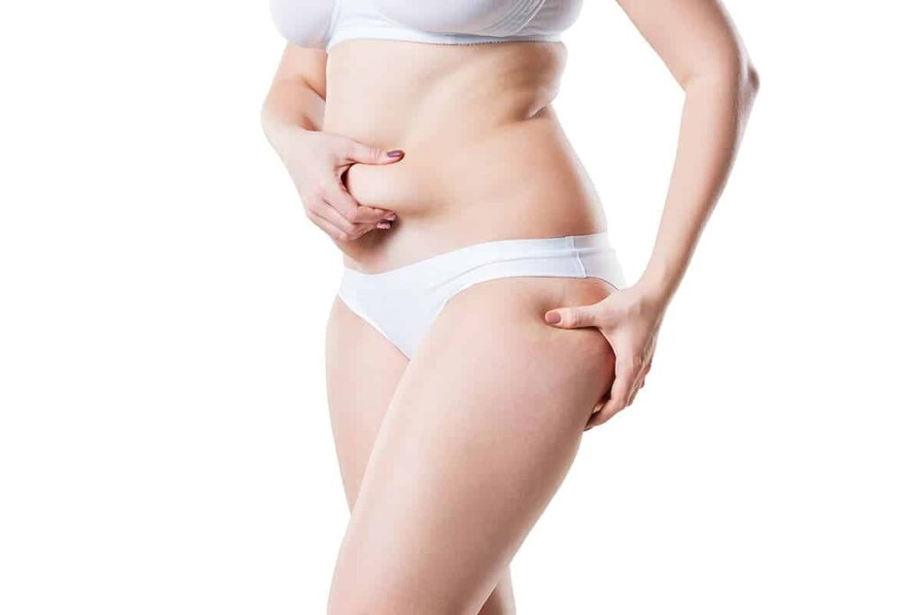 Femme montre l'excédent de la graisse ventre et cuisses Mythes sur la liposuccion - Dr Favre Lausane